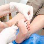 Top 10 Best Foot Callus Removers of [y]