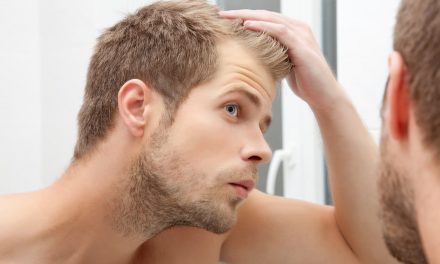 Top 10 Best Hair Loss Treatments for Men of 2022
